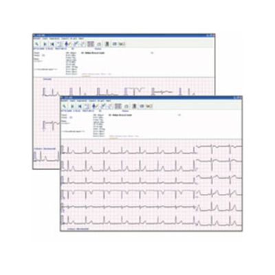 Phần mềm quản lý dữ liệu điện tim EFS-200